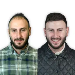 DHI Unshaved