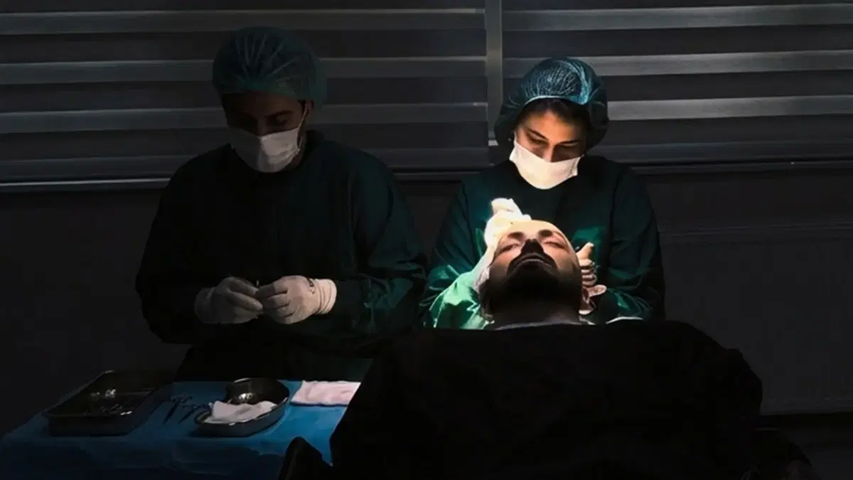 O que é o transplante capilar DHI?