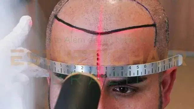 A Manhã Do Seu Procedimento