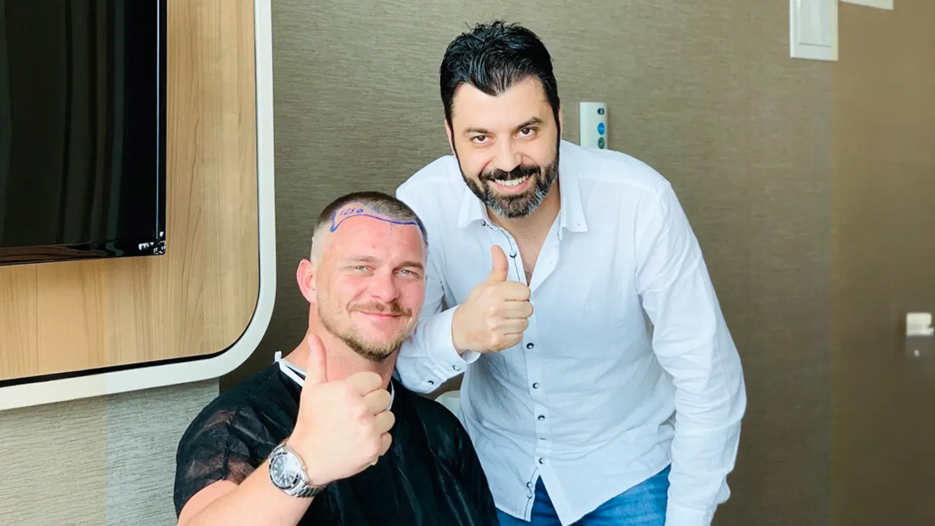 TRANSPLANTE CAPİLAR FUE SAFİRA