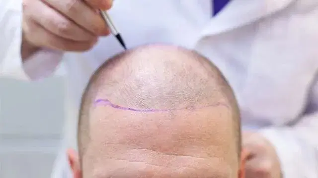 antes-do-inicio-da-operacao